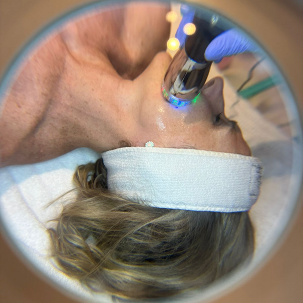 Dermaplaning + Electroporador