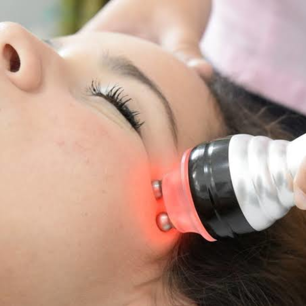 Radiofrecuencia Facial 