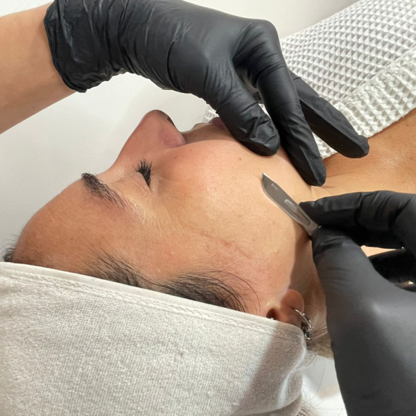 Limpieza de cutis profunda con dermaplaning ( EFECTIVO $50.000)