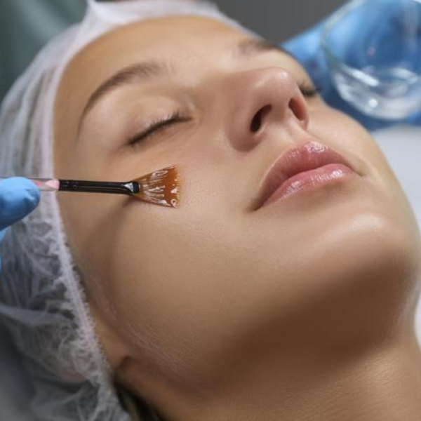 Limpieza de cutis profunda con Peeling (EFECTIVO $48.000)