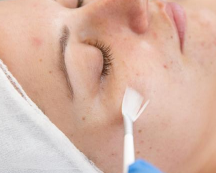 Limpieza Facial  con peeling retinol - (EFECTIVO $48.000)