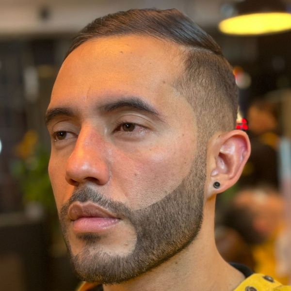PIGMENTACION DE  BARBA 