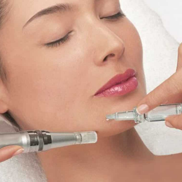 Valoración Dermapen (Aclarado, Revitalizante, Hidratante)