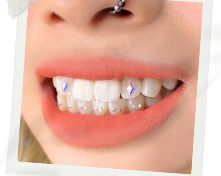 Joyería dental (Diseño Piercing con formas)