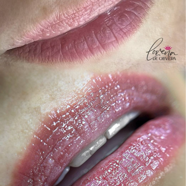 Hidra Lips