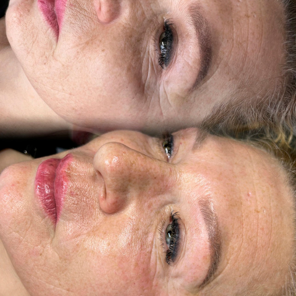 Tratamiento Facial Visage Diamons (tratamientos personalizados) Con aparatologia