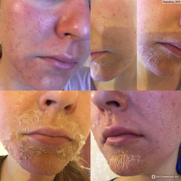 Peeling Organico de Algas