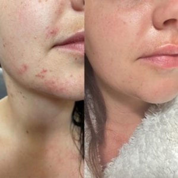 Peeling Organico de Algas