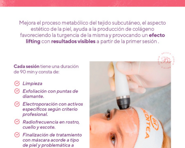 Radiofrecuencia Facial 