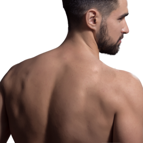 Depilacion Definitiva Espalda Hombre