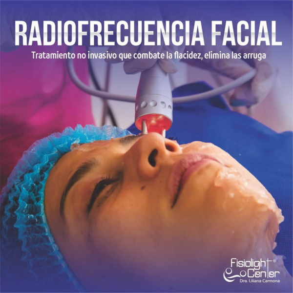RADIOFRECUENCIA FACIAL