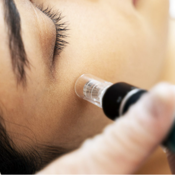 DETOX FACIAL + DERMAPEN 