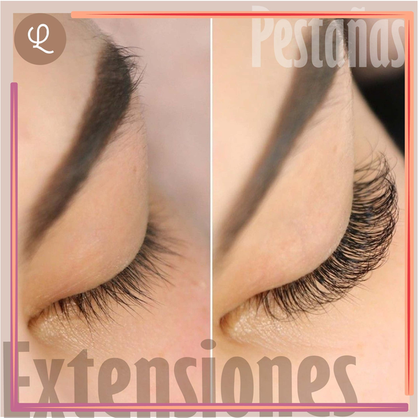 Retoque Ext Clasica 16 a 20 Días 