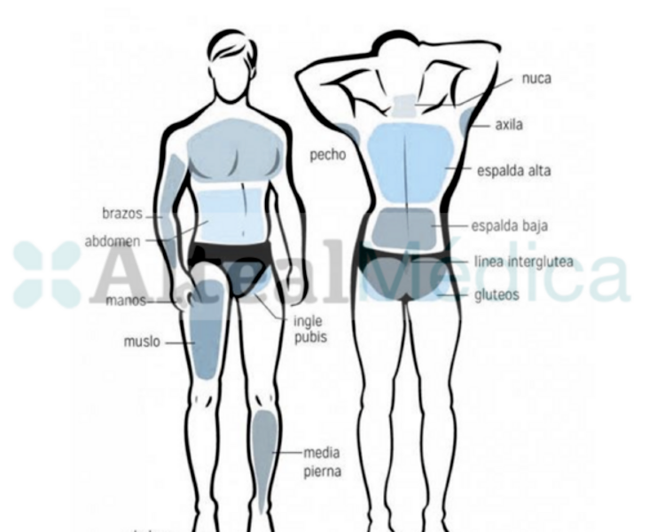  LINEA DE ABDOMEN (1 sesión) Depilación Láser Diodo