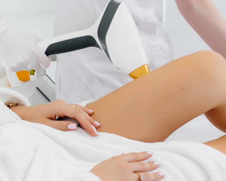 MEDIAS PIERNAS ALTAS (1 sesión) Depilación Láser Diodo