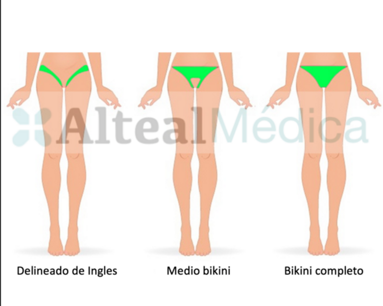 MEDIO BIKINI (1 sesión) Depilación Láser Diodo