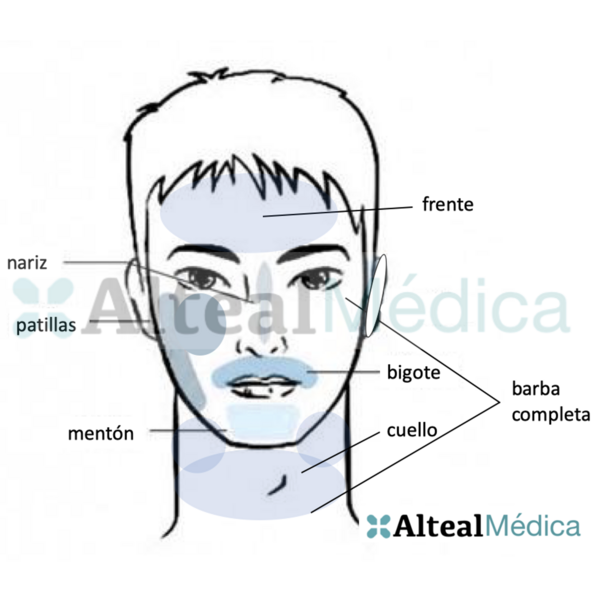 NARIZ (1 sesión) Depilación Láser Diodo