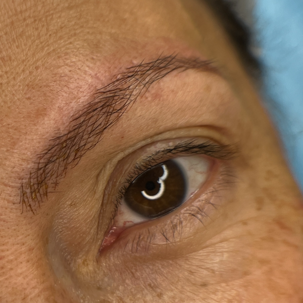 Nanoblading - CEJAS HD 