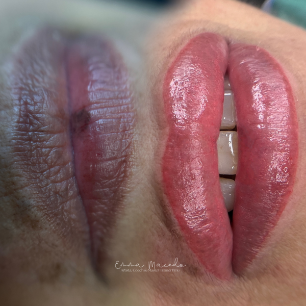 NEUTRALIZACION DE LABIOS 
