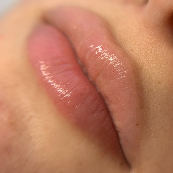 Spa de Labios (1 sesión)