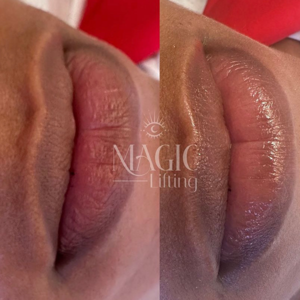 3 sesiones Spa de Labios