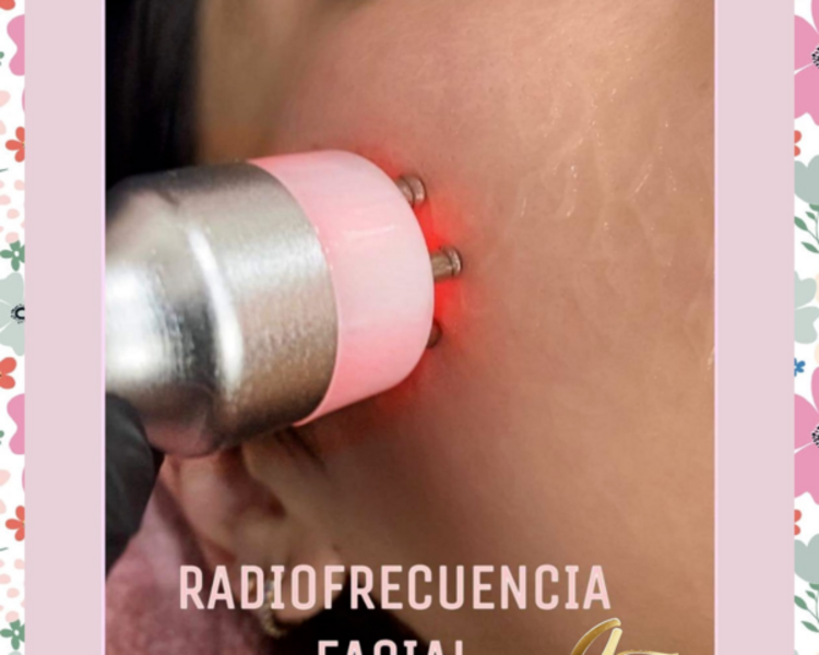 RADIOFRECUENCIA FACIAL