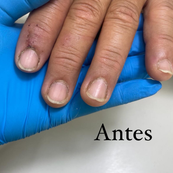 Manicura para hombres💅🏻🙋🏻‍♂️