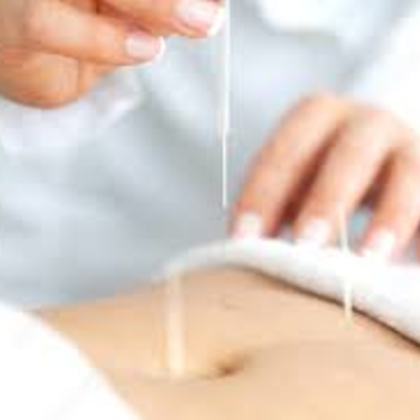 Acupuntura Abdominal 
