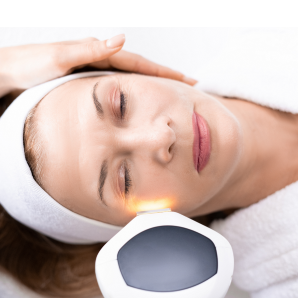 FOTOREJUVENECIMIENTO FACIAL