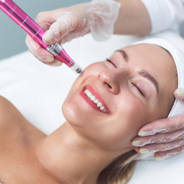 Microdermoabrasión Punta Diamante