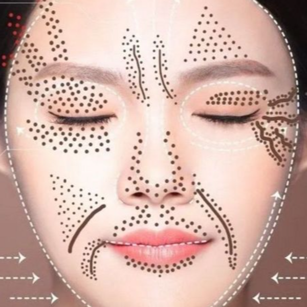 MICROPUNTURA Incluye una sesión de Microneedling