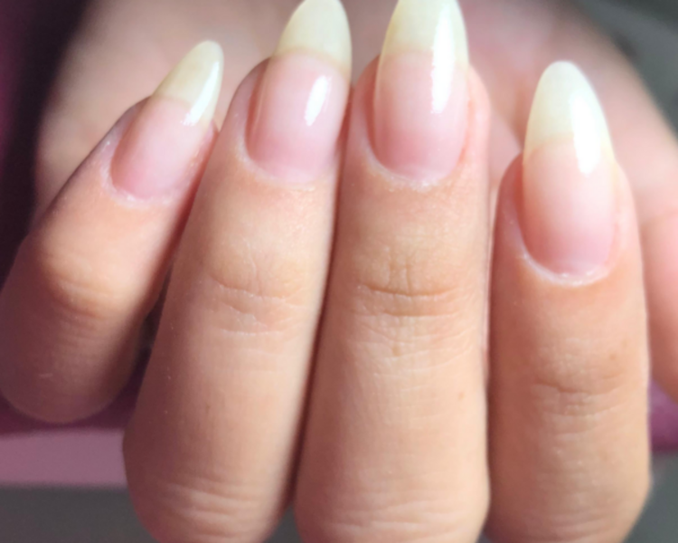 Retiro semi/kapping con belleza y calcio