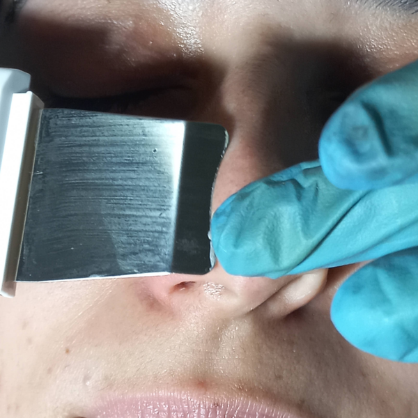 Limpieza facial profunda 