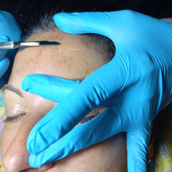 Dermaplaning 
