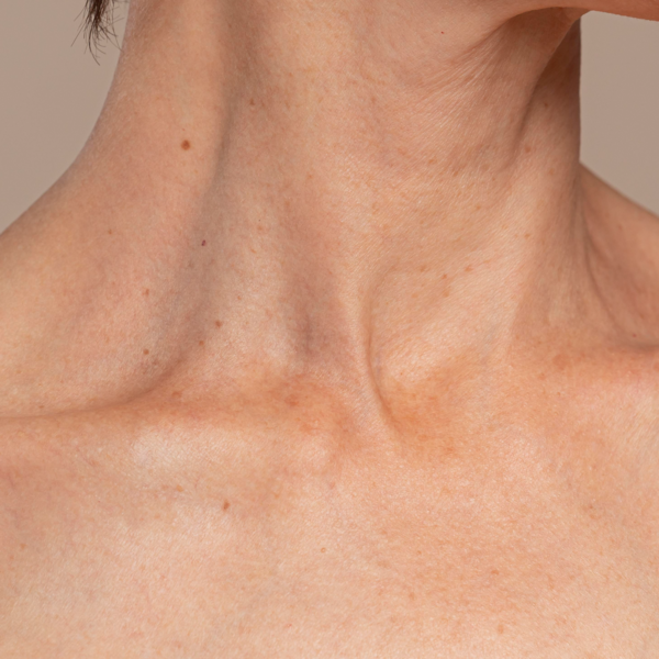 Hifu Cuello (2S)