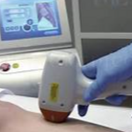 Depilación Definitiva photo