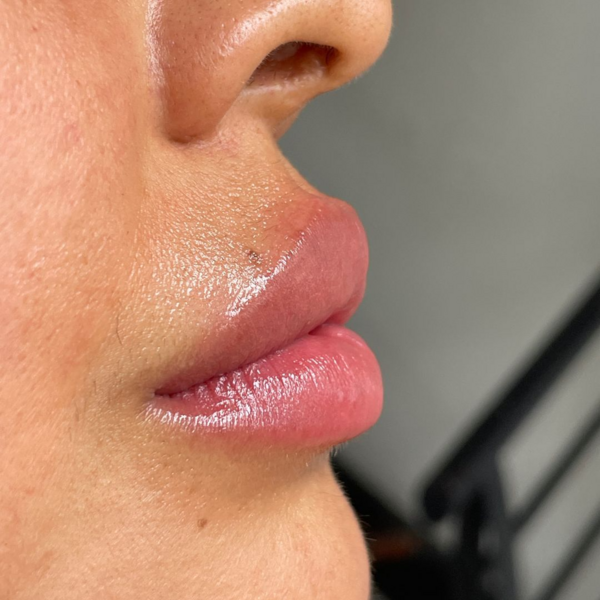 Neutralización de labios