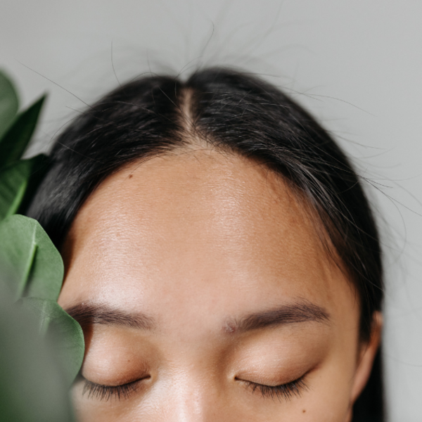 Depilación Láser Frente 12 Sesiones