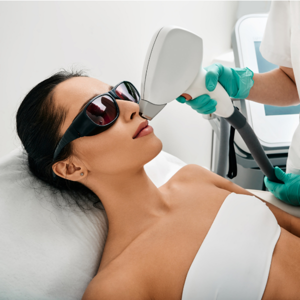 Depilación Láser a Bigote sesión 