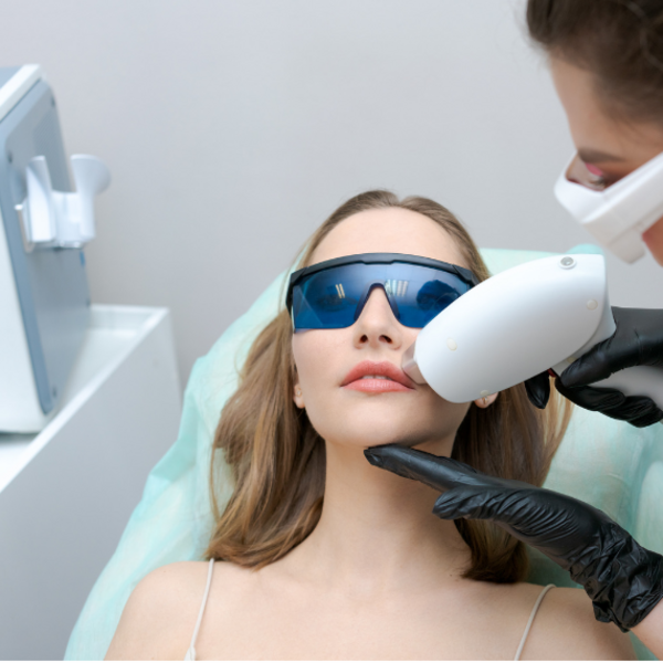 Depilación Láser Bigote 12 Sesiones