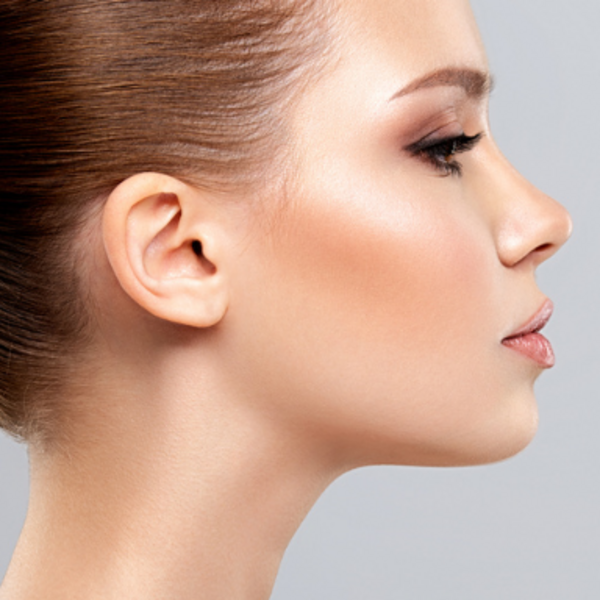 Depilación Láser Patillas 12 Sesiones