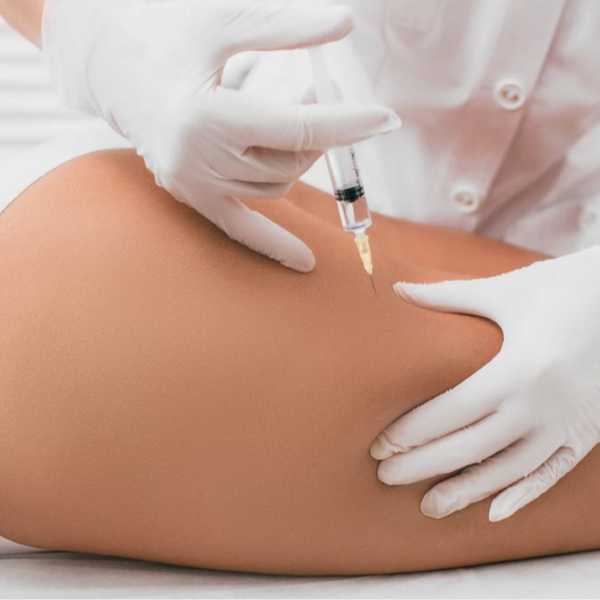 Mesoterapia/Fosfatidilcolina