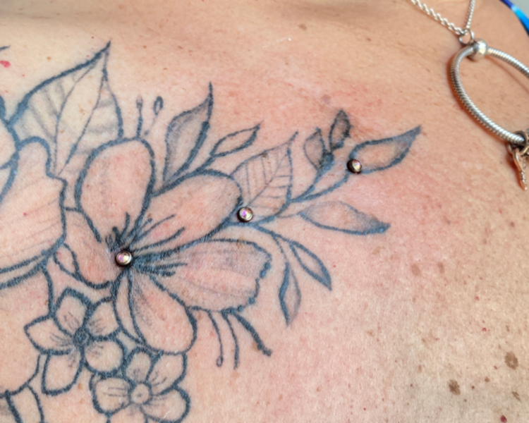 Microdermal