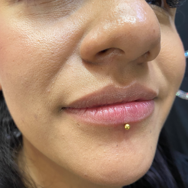 Perforación Labret