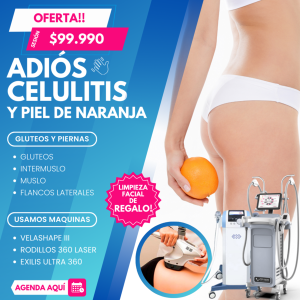 Adiós Celulitis y Piel de Naranja (Retoque ó Nueva Sesión) - BLACK FRIDAY PROMO