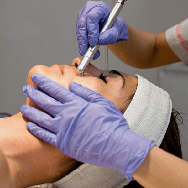 Limpieza Facial Profunda + Electroporador