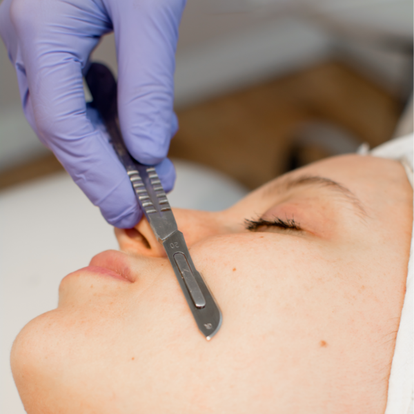 Peeling quimico + Dermaplaning