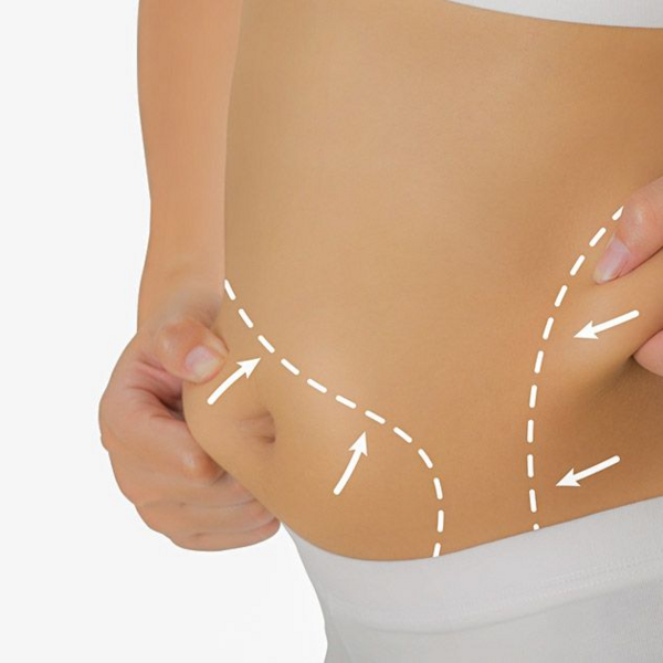 Combo reductor de abdomen o flancos