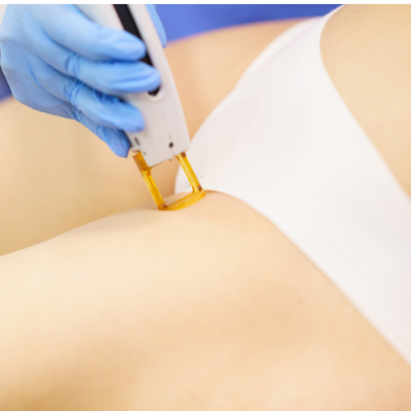 Depilación de Ingle por Sesión