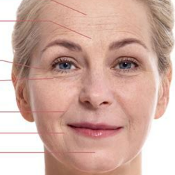 SESIONES ESPECÍFICAS (Acné, Anti-edad, Rosácea, etc.)